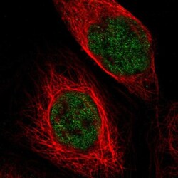 TSPAN2 Antibody, Novus Biologicals 0.1mL; Unlabeled:Antibodies, Polyclonal